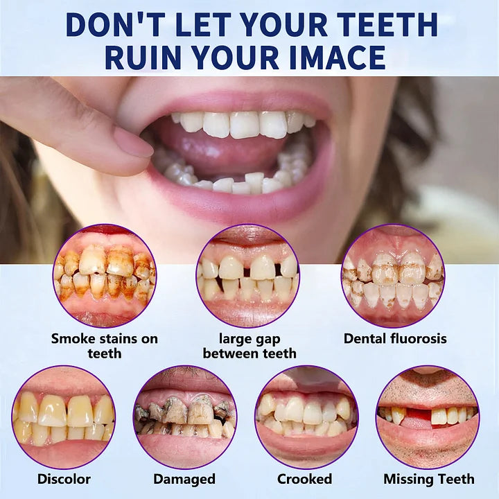 NESLEMYā¢-š¦·Advanced Customized Full Denture Set𦷠(ā°Limited time discount last 30 minutesā°)