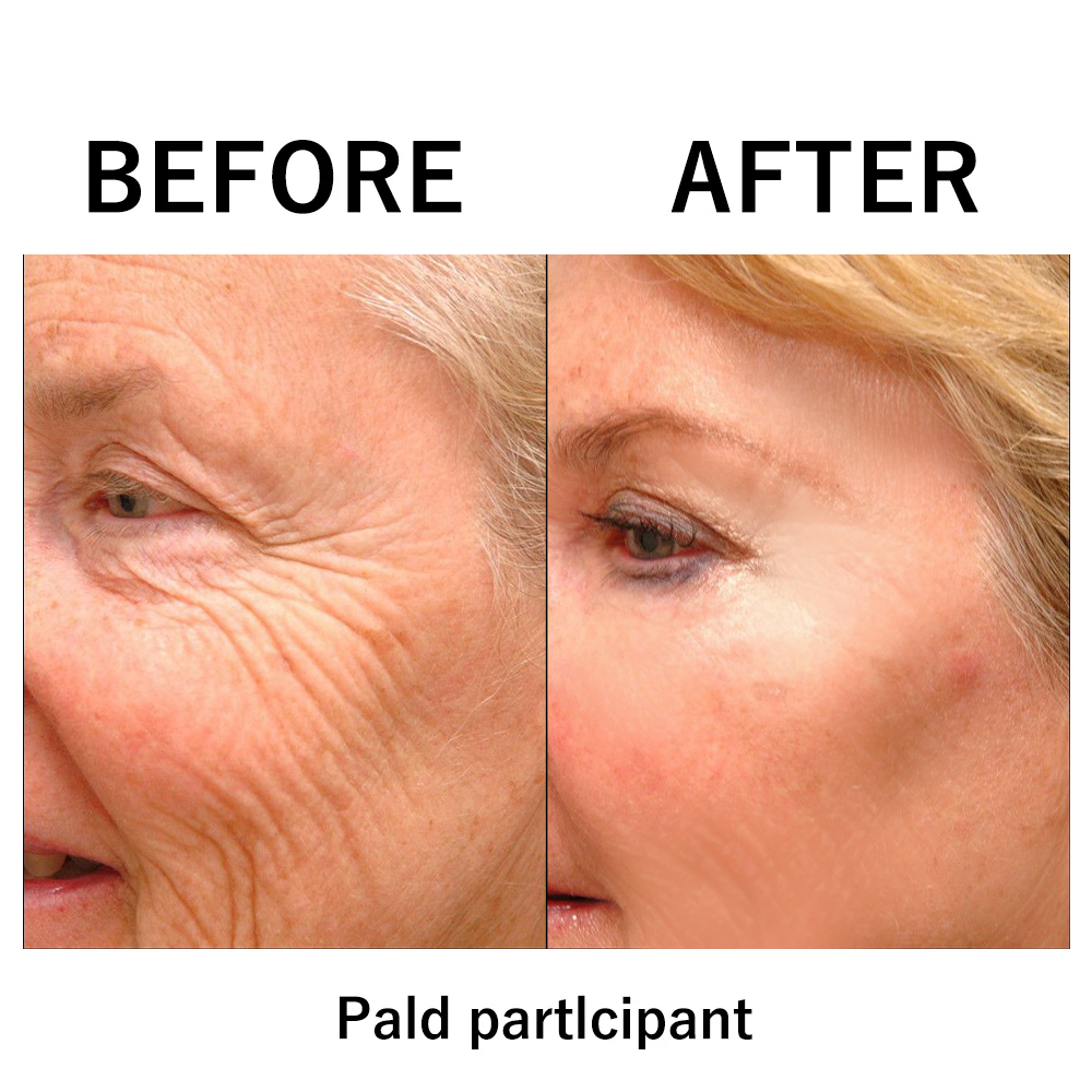 đĽ Last Day Discount: 87% OFF đ¸Instant Temporary Face Tightener