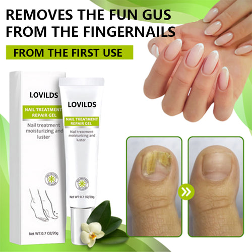 LOVILDS™ ELIMINA LOS HONGOS DE LAS UÑAS EN 5 DÍAS Y EVITA QUE APEREZCAN PARA SIEMPRE🔥55% Off for a Limited Time!