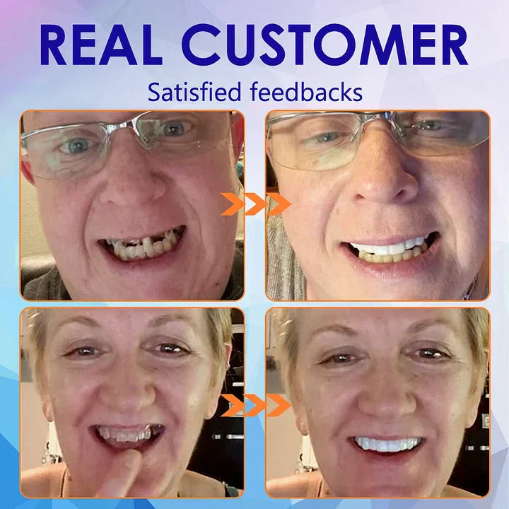 NESLEMYā¢-š¦·Advanced Customized Full Denture Set𦷠(ā°Limited time discount last 30 minutesā°)