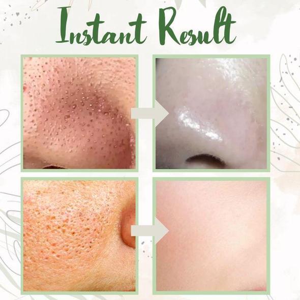 Final Sale -BBOJI Green Tea Deep Cleanse Mask - (Limited time discount 🔥 last day)