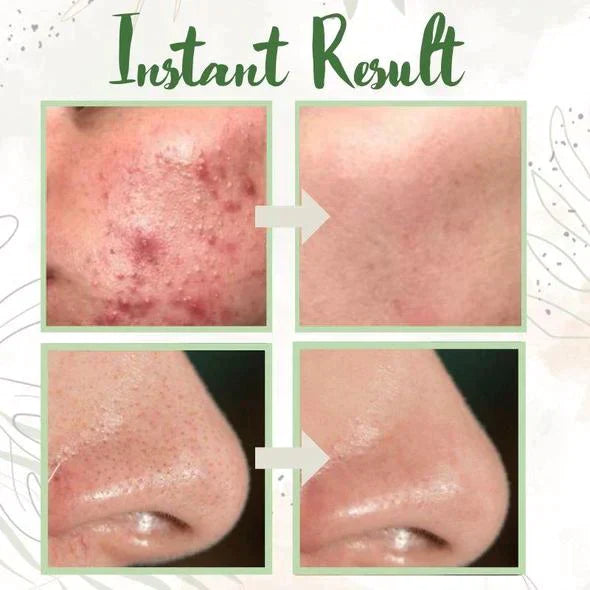 Final Sale -BBOJI Green Tea Deep Cleanse Mask - (Limited time discount 🔥 last day)