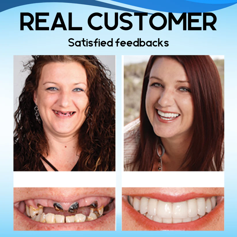 NESLEMY™ Silicone Reline Denture Set