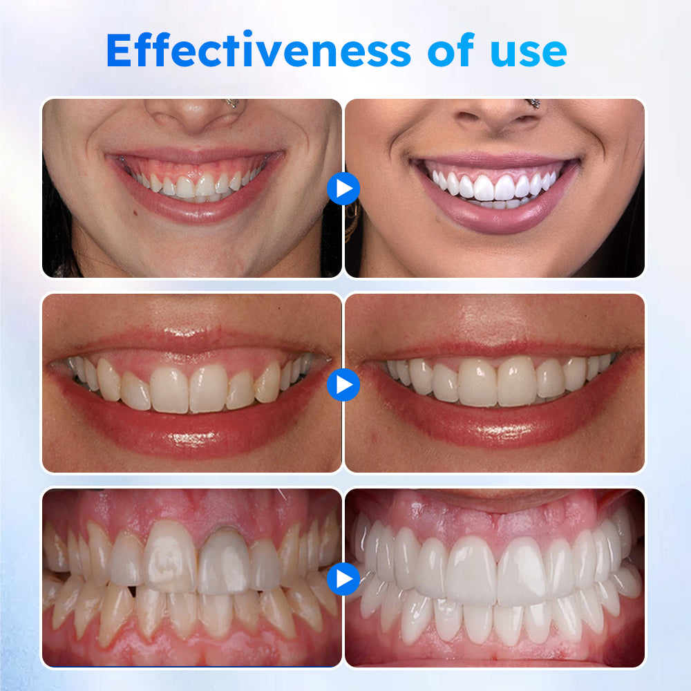 LOVILDS™ Oral Gum Treatment Gel(Limited Time Discount 🔥 Last Day)