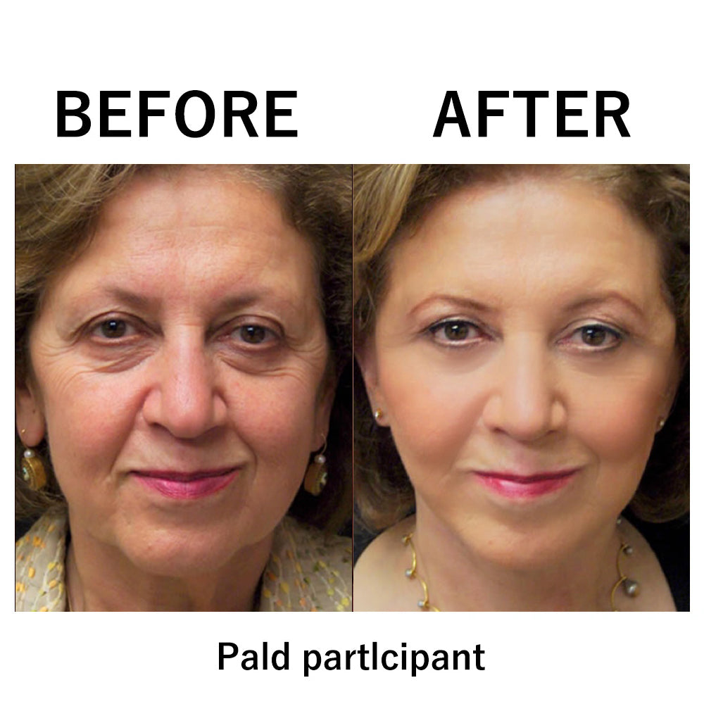 đĽ Last Day Discount: 87% OFF đ¸Instant Temporary Face Tightener
