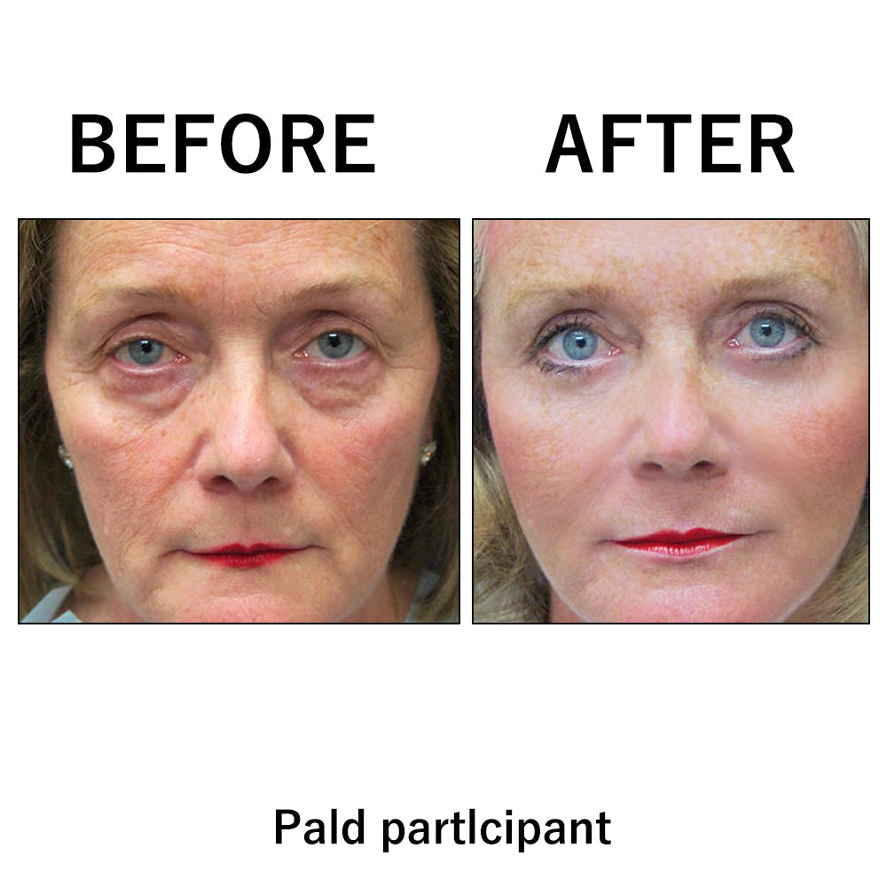 đĽ Last Day Discount: 87% OFF đ¸Instant Temporary Face Tightener