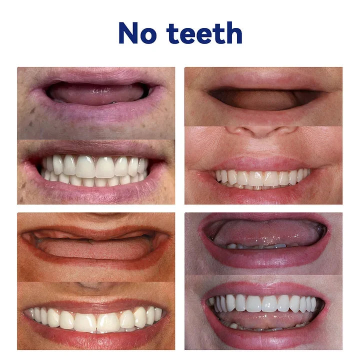 NESLEMYā¢-š¦·Advanced Customized Full Denture Set𦷠(ā°Limited time discount last 30 minutesā°)