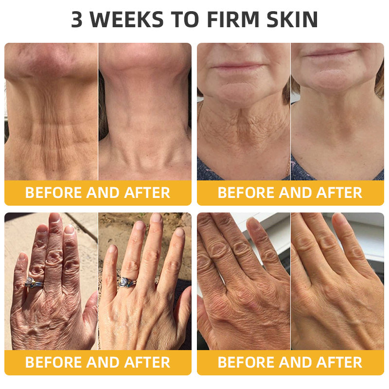 BBOJIโขApiotherapy Retinol Skin Salve Ointment ๐๐๐๐ ๐๐๐๐๐๐๐๐๐๐(๐ฅ55% Off for a Limited Time!)