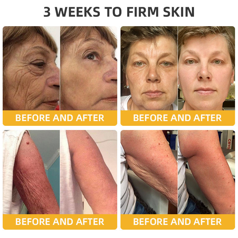 BBOJIโขApiotherapy Retinol Skin Salve Ointment ๐๐๐๐ ๐๐๐๐๐๐๐๐๐๐(๐ฅ55% Off for a Limited Time!)