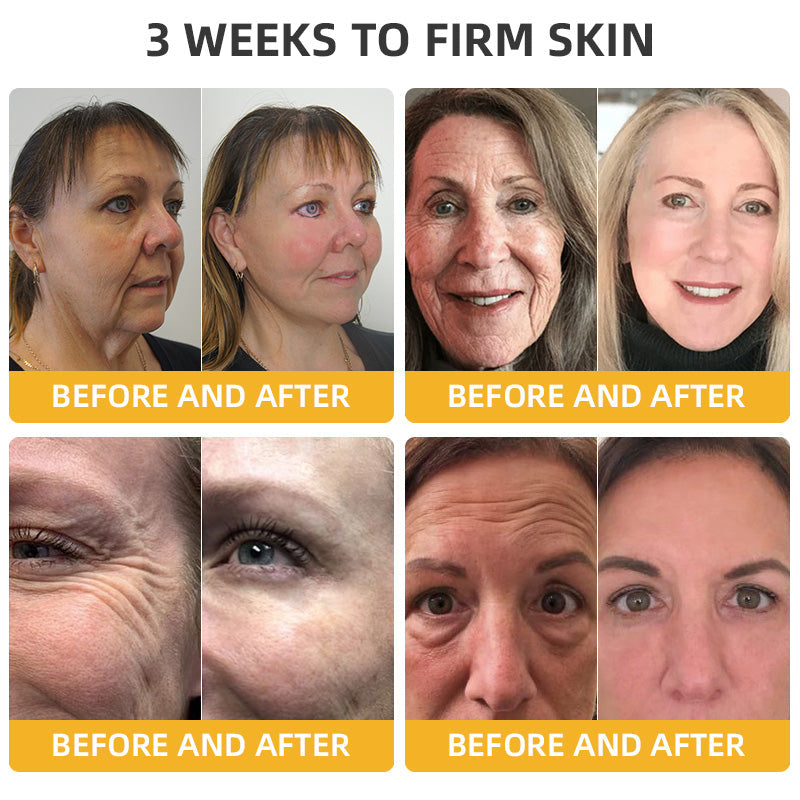 BBOJIโขApiotherapy Retinol Skin Salve Ointment ๐๐๐๐ ๐๐๐๐๐๐๐๐๐๐(๐ฅ55% Off for a Limited Time!)