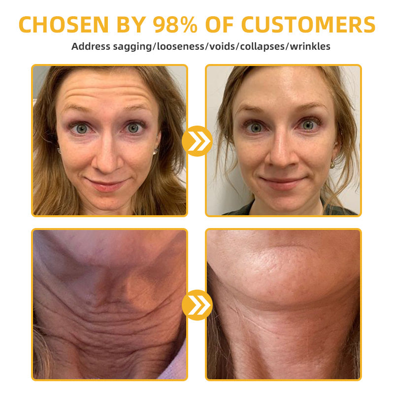 BBOJIโขApiotherapy Retinol Skin Salve Ointment ๐๐๐๐ ๐๐๐๐๐๐๐๐๐๐(๐ฅ55% Off for a Limited Time!)