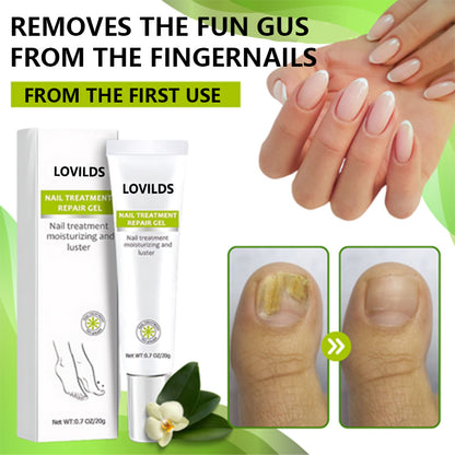 LOVILDS™  ELIMINA LOS HONGOS DE LAS UÑAS EN 5 DÍAS Y EVITA QUE APEREZCAN PARA SIEMPRE🔥55% Off for a Limited Time!