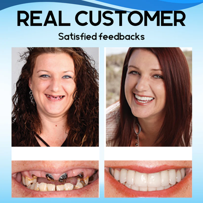 NESLEMY™ Silicone Reline Denture Set