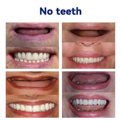 NESLEMY™-🦷Advanced Customized Full Denture Set🦷 (⏰Limited time discount last 30 minutes⏰)