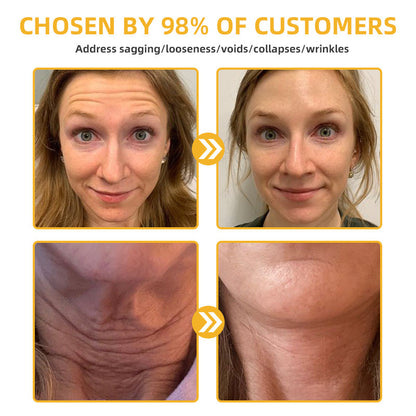 BBOJI™Apiotherapy Retinol Skin Salve Ointment 🐝𝐀𝐀𝐃 𝐑𝐄𝐂𝐎𝐌𝐌𝐄𝐍𝐃𝐒(🔥55% Off for a Limited Time!)