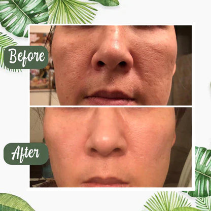 Final Sale -BBOJI Green Tea Deep Cleanse Mask - （Limited time discount 🔥 last day）
