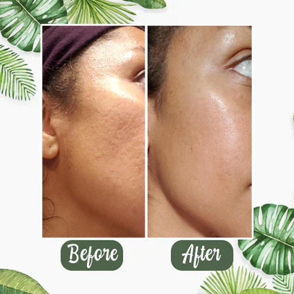 Final Sale -BBOJI Green Tea Deep Cleanse Mask - （Limited time discount 🔥 last day）