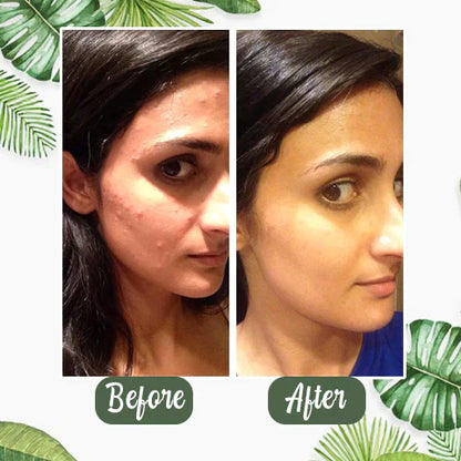 Final Sale -BBOJI Green Tea Deep Cleanse Mask - （Limited time discount 🔥 last day）